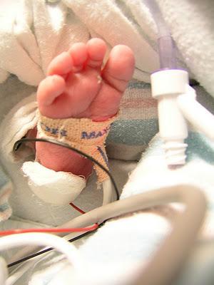 ¿Para qué sirve un pulsioxímetro? ¿Para qué sirve un pulsioxímetro?