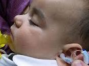 Audífono para bebés Pamplona