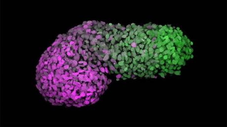 Realizan nuevos hallazgos sobre el origen de la esquizofrenia