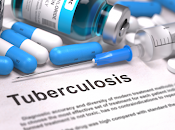 Vacuna contra tuberculosis pasa prueba seguridad