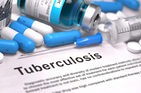 Vacuna contra la tuberculosis pasa prueba de seguridad