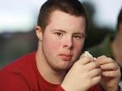 Nuevo tratamiento mejora síndrome Down