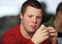 Nuevo tratamiento mejora el síndrome de Down Nuevo tratamiento mejora el síndrome de Down