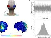 ¿Puede ruido aleatorio transcraneal mejorar aprendizaje?