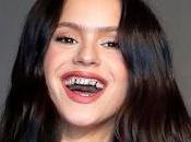 Dame veneno