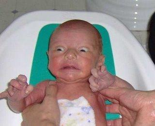 Cómo reanimar mal a un recién nacido: manual práctico
