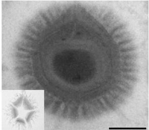 Megavirus, hallado en Chile el virus más grande del mundo