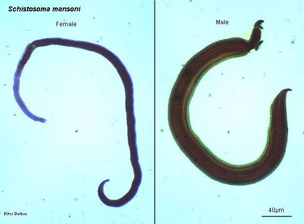 Diagnóstico y manejo de la esquistosomiasis