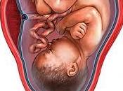 rotura prematura bolsa