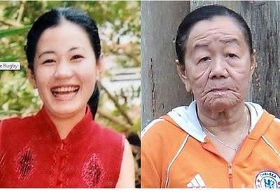 Una joven envejeció 50 años en pocos días