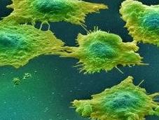 Factores riesgo para desarrollo células cancerígenas