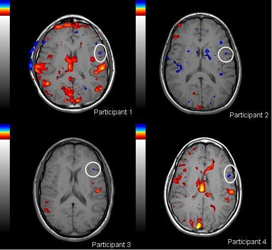 Cosas importantes sobre la anestesia en tomografía y resonancia magnética en niños (1)