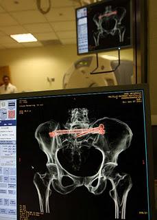 Innovación y experiencia, binomio indisoluble de las UMAE de traumatología y ortopedia a 30 años de su creación