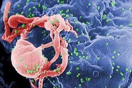 Hallan una forma de evitar que el virus del SIDA dañe el sistema inmune.