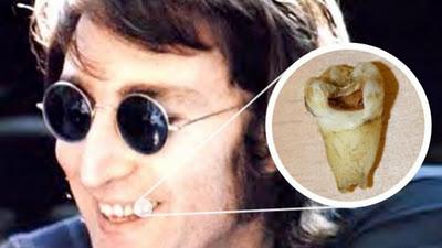 Diente de John Lennon en subasta