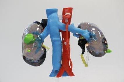 Asseco Spain desarrolla órganos en 3D que minimizan riesgos en las operaciones de trasplante