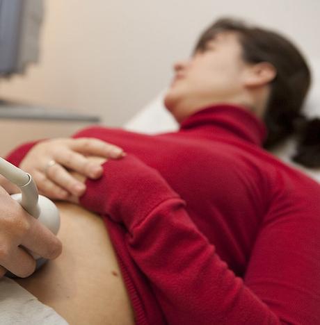 LA CONGELACIÓN DE OVULOS SE DUPLICA LA CONGELACIÓN DE OVULOS SE DUPLICA