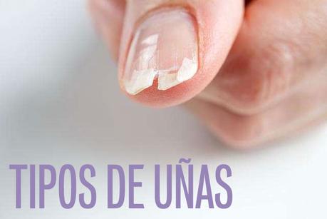 tipos de uñas quebradizas debiles