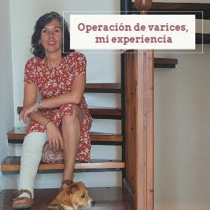Mi operación de varices: Te cuento