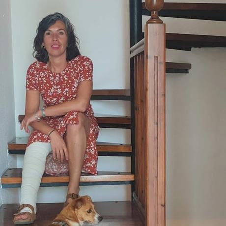 día siguiente Mi operación de varices: Te cuento 03