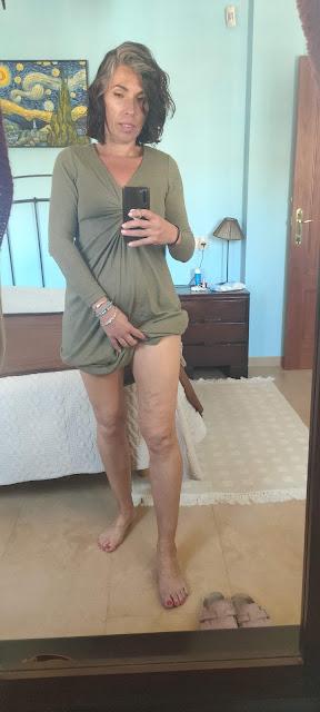 variz Mi operación de varices: Te cuento 02