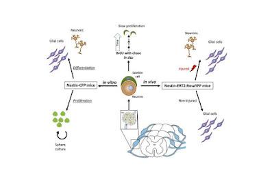 Regeneran neuronas dañadas con células madre Regeneran neuronas dañadas con células madre