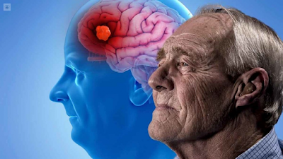 El Alzheimer se puede diagnosticar antes que aparezca El Alzheimer se puede diagnosticar antes que aparezca