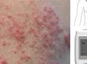 Vacuna contra Holter