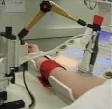 ¿Cómo calcular la edad vascular con las escalas del sistema score?