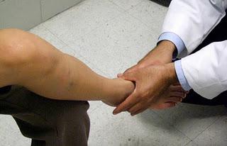 Elevados niveles de ácido úrico incrementan los riesgos de sufrir gota