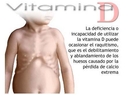 Que es el Raquitismo