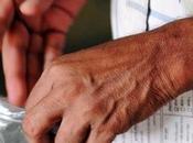 hombre recibe transplante doble manos EEUU