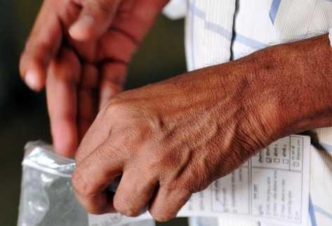 Un hombre recibe un transplante doble de manos en EEUU