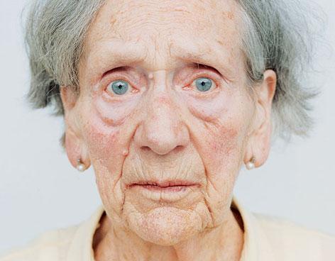 Ocultan las causas del Alzheimer y el Parkinson?