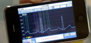 Diseñan un aparato que alerta por SMS si detecta un problema cardiaco.