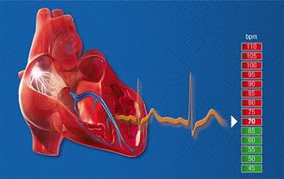 Hospitalización por enfermedad cardiovascular