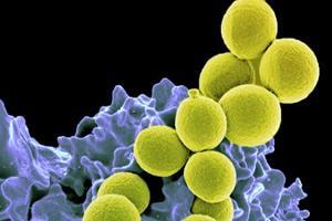 Estas son las bacterias más peligrosas para la humanidad