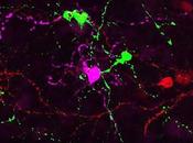 Desarrollan células ganglionares para tratar lesiones Oculares