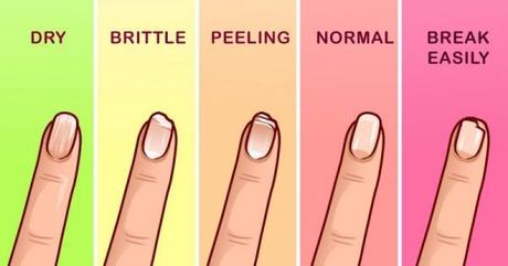 QUÉ DICEN TUS UÑAS SOBRE TU SALUD?!