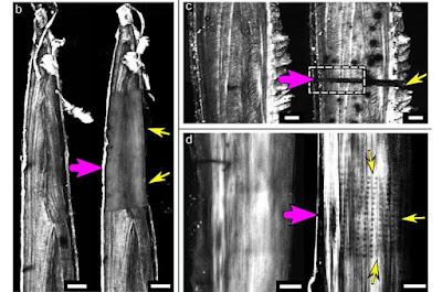 Los RX intensos dañan las fibras de colágeno