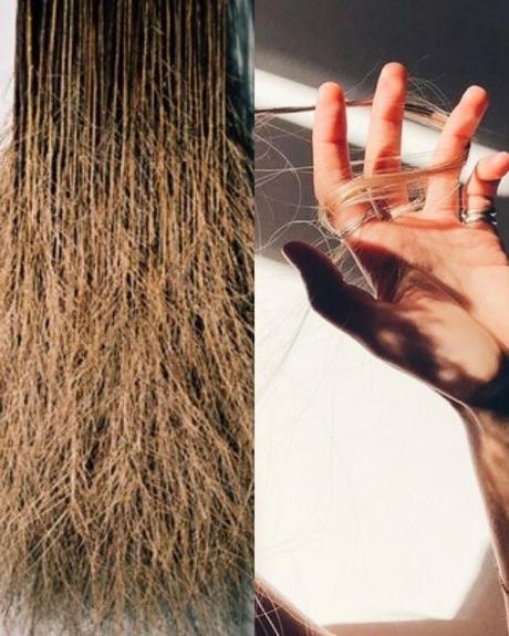 Cuidado del cuero cabelludo