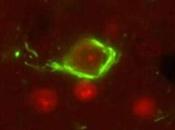 Investigan otra diana terapéutica para enfermedad Alzheimer