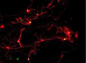 Cada esta cerca curar definitivamente ceguera