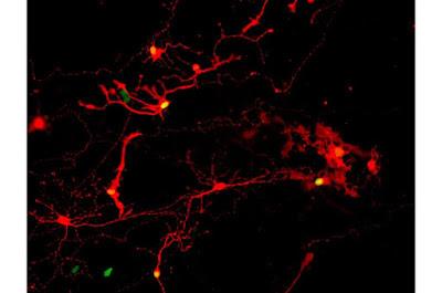 Cada día se esta mas cerca de curar definitivamente la ceguera Cada día se esta mas cerca de curar definitivamente la ceguera