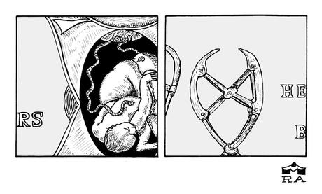 Dibucedario 2023/ I / Inseparables (David Cronenmberg, 1988)