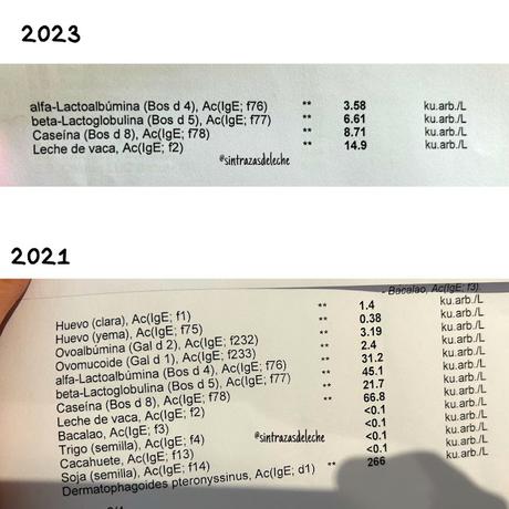 Resultados analíticas de alergia y niveles de Ige