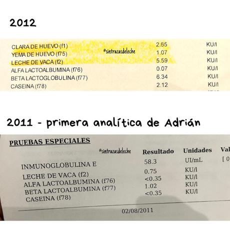 Resultados analíticas de alergia y niveles de Ige