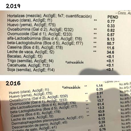 Resultados analíticas de alergia y niveles de Ige