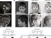 Descubren nueva condición neurológica