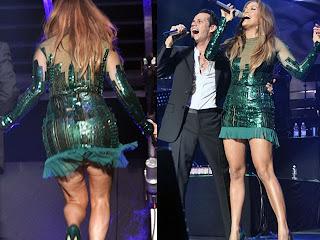 100 SEGUIDORAS!!! Y LUCHAR CONTRA LA CELULITIS I: CAUSAS Y TIPOS 100 SEGUIDORAS!!! Y LUCHAR CONTRA LA CELULITIS I: CAUSAS Y TIPOS